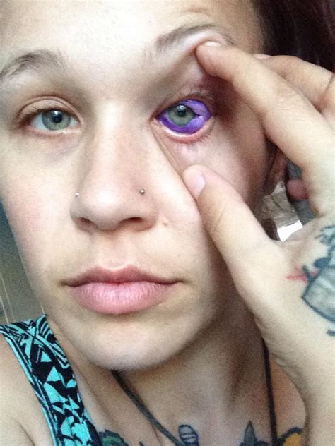 Woman cried blue tears, went blind after tattooing her eyeballs